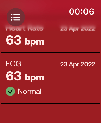 WatchOS user interface for the Withings application